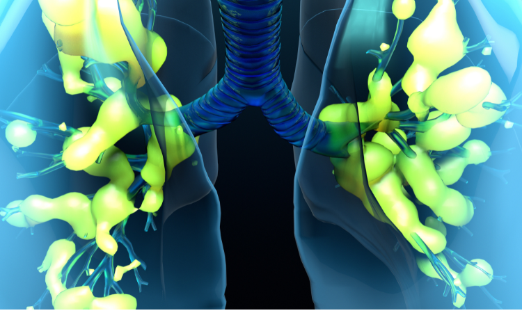 Acute Respiratory Distress Syndrome Market, Size, Forecast Report 2023-2028