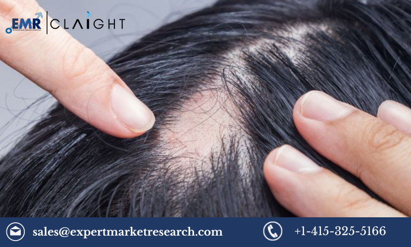 Alopecia Market Size, Share, Growth, Report 2024-2032