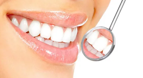 Teeth Whitening Marrickville Treatments: Cost Expectations