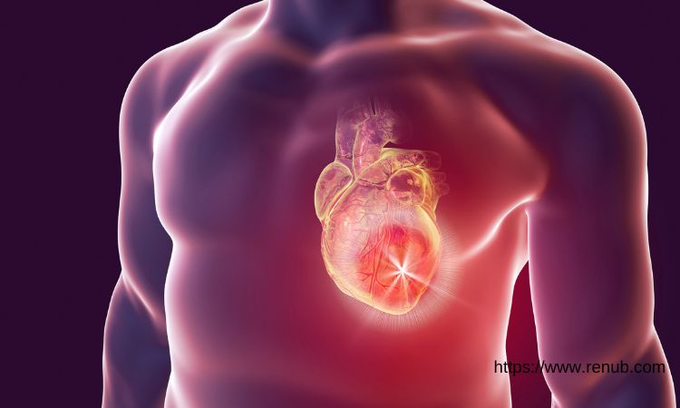 Global Myocardial Infarction Market Outlook: Drug Classes, Distribution Channels, Regional Insights, and Company Profiles (2024-2032) ⅼ Renub Research