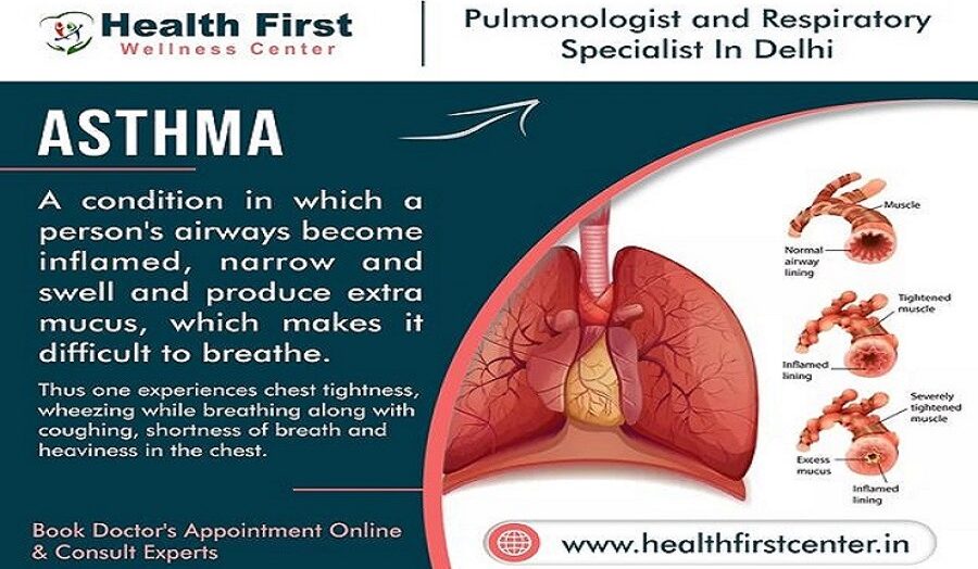 Asthma Doctor