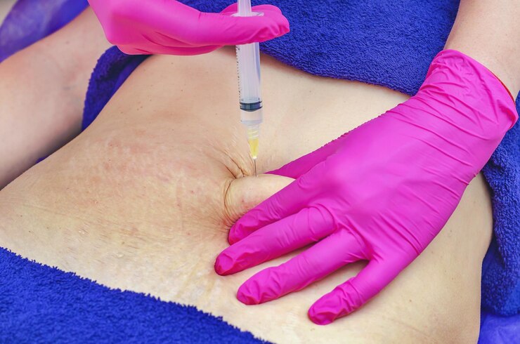 Fat Injections in Dubai