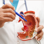 Affordable Gastric Bypass Surgery for Weight Loss in Pakistan