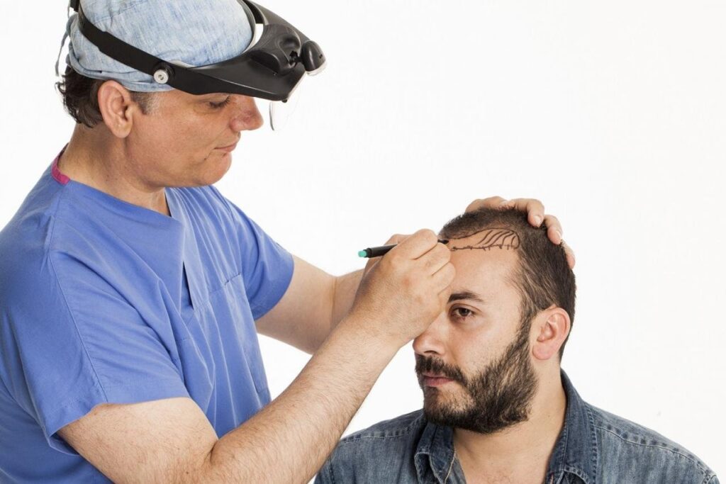 Hair Transplant in Dubai