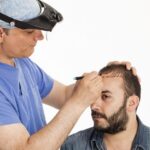 Does ClearLift Laser Work on Acne Scars?