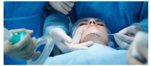 Plastic Surgery in Lucknow