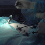 Why SEBI Keeps Tweaking Futures and Options Rules